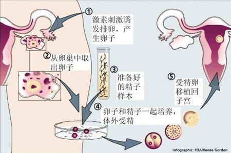 代生儿子包性别